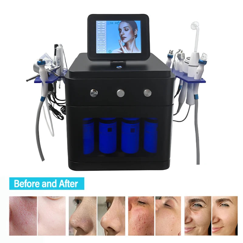 14-in-1 Hydro Facial Machine Professional Deep Cleansing Blackhead Remover & Pore Minimizer for Salon/Home